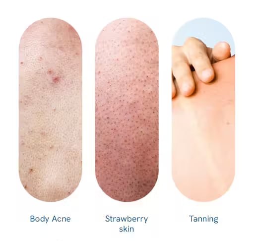 Be Bodywise 10% AHA Exfoliating Body Scrub 200g | Chemical & Physical Exfoliation for Smooth Skin | Removes Dead Skin Cells & Improves Skin Texture