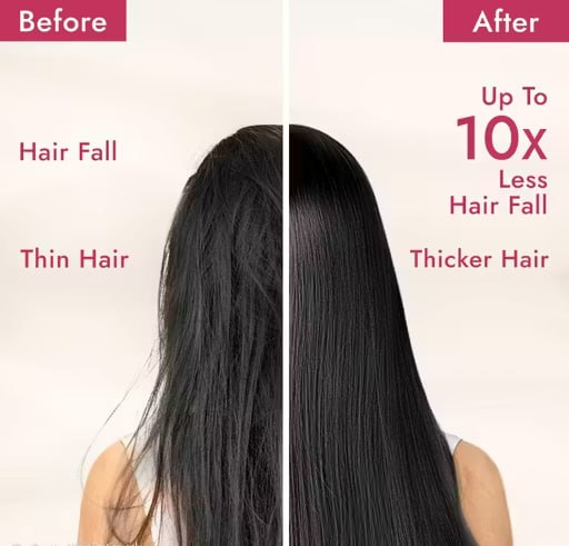 Onion Hair Growth Shampoo Combo – Shallot Onion & Amla Extracts | Strong, Thick & Healthy Hair | 200ml × 2