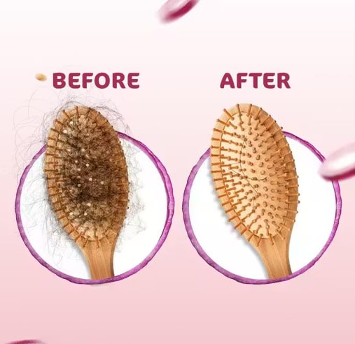 Mamaearth Onion Hair Oil – Hair Fall Control & Hair Growth | Strong, Smooth & Healthy Hair | 200ml